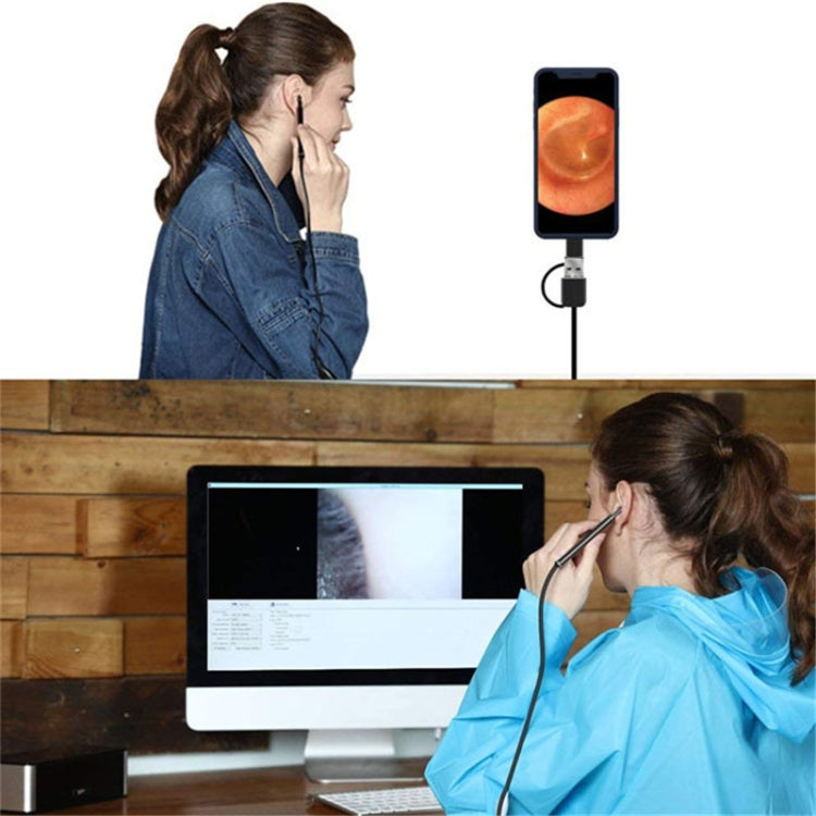 3 in 1 USB HD Digital Inspection Otoscope Ear Type Digital Endoscope Ear Wax - HoMEdemic™ 