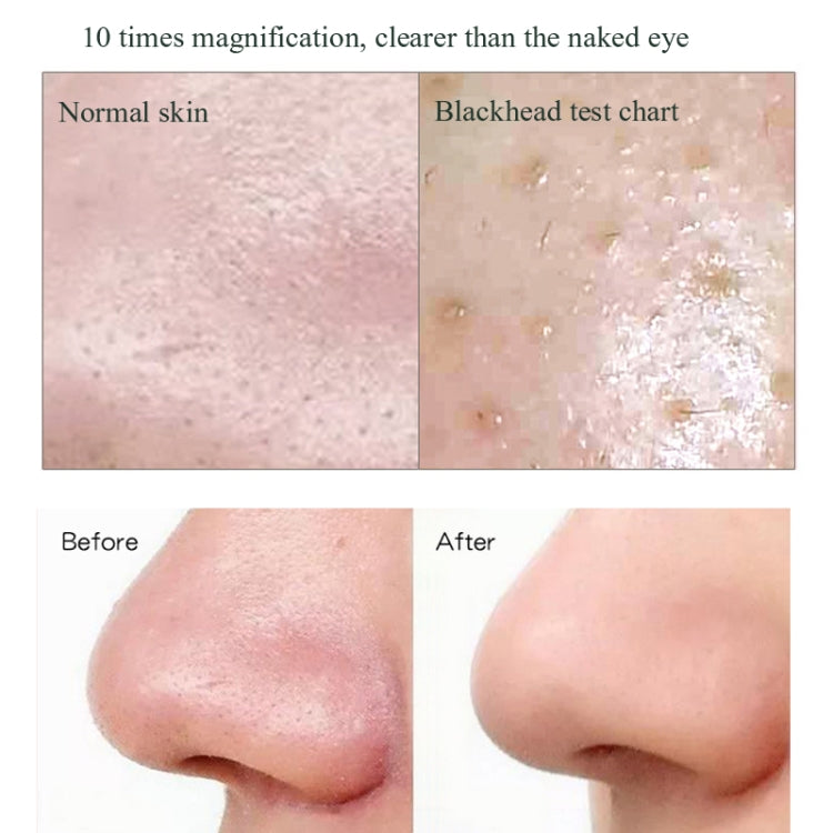 Blackhead Electric Pore Removal Machine Clean Facial Equipment,Style: Visual Model - HoMEdemic™ 