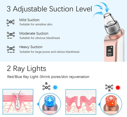 ANLAN X7 Facial Pore Cleaner Blackhead Removal Device - HoMEdemic™ 