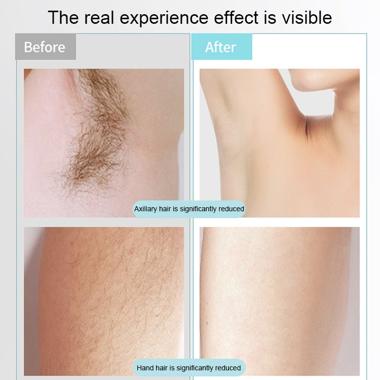 K_SKIN KD506A Epilator Household Freezing Photon Hair Removal Instrument 5 Levels of Light Intensity for Cheek Armpit Leg Back - HoMEdemic™ 