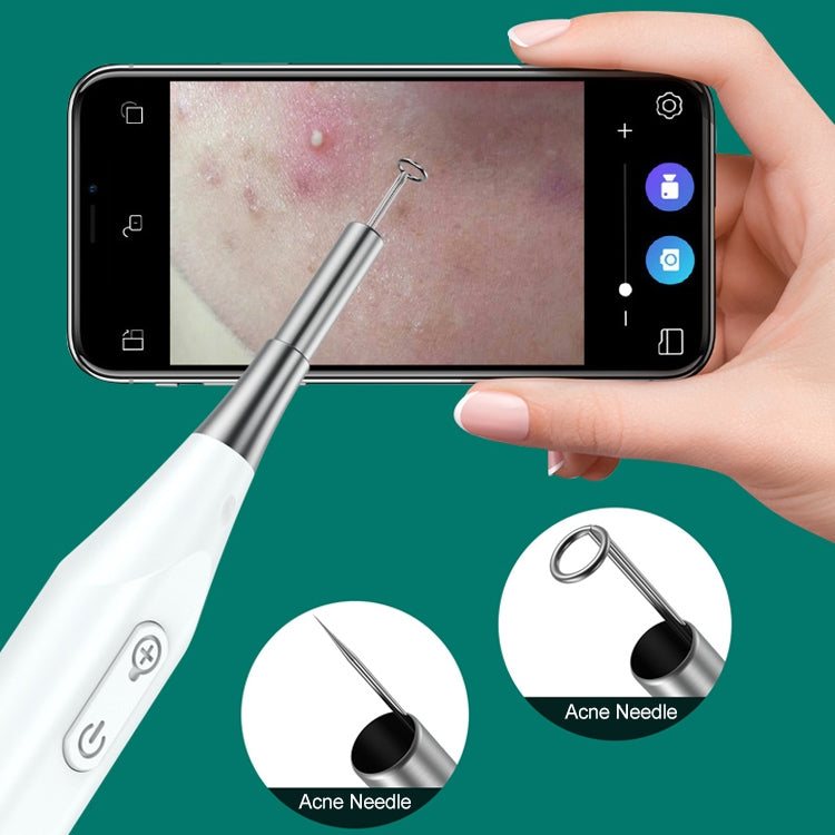 Supereyes Y009 Visual Ear Pick Acne Cleaning Microscopic Magnifying Mirror Endoscope - HoMEdemic™ 