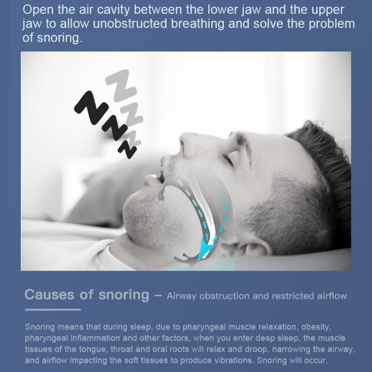 YJK100 Silicone + ABS Stop Snoring Device Anti Snore (White) - HoMEdemic™ 