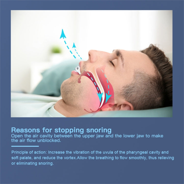 YJK100 Silicone + ABS Stop Snoring Device Anti Snore (White) - HoMEdemic™ 