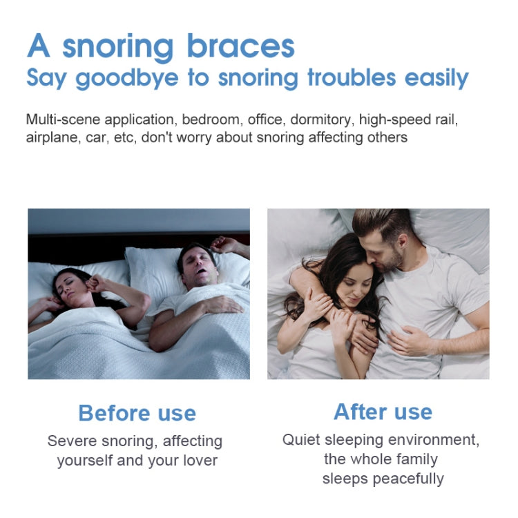 YJK100 Silicone + ABS Stop Snoring Device Anti Snore (White) - HoMEdemic™ 